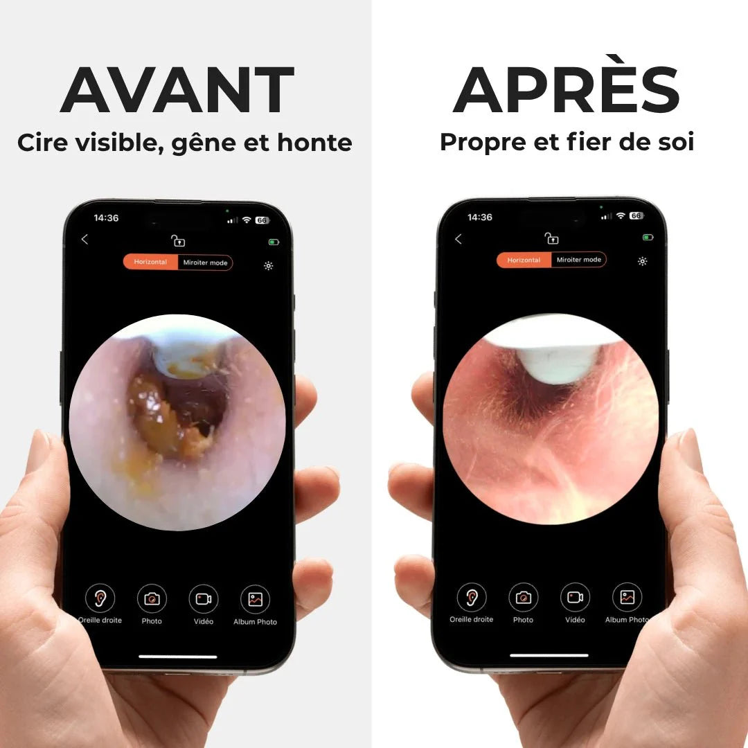 OreilleClair™ – Nettoyeur d’oreille avec caméra HD