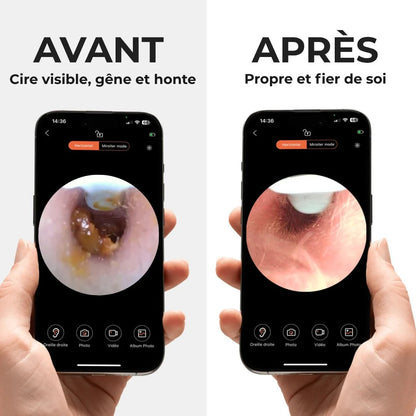 OreilleClair™ – Nettoyeur d’oreille avec caméra HD