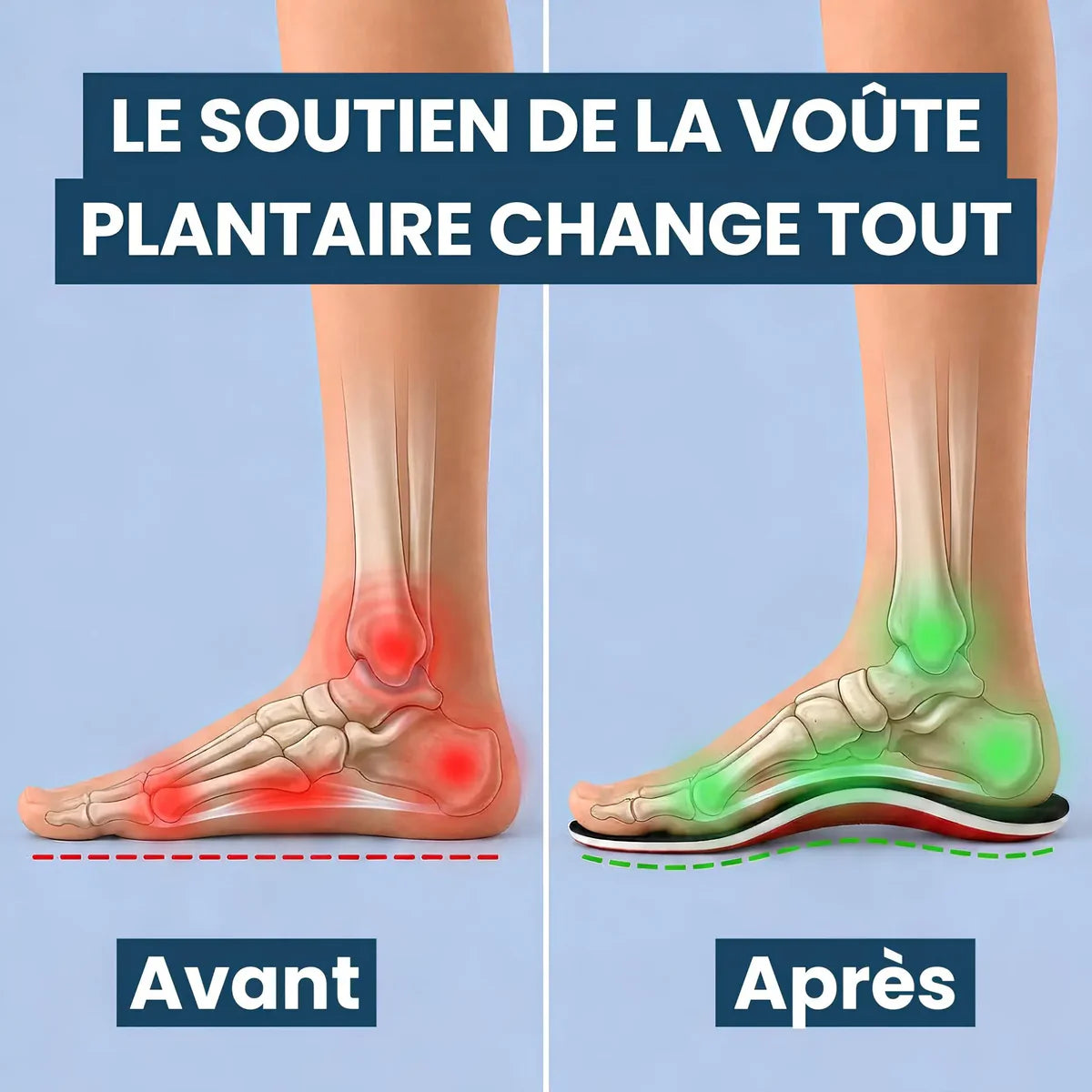 PiedsRelax™ – Semelles confort pour la voûte plantaire